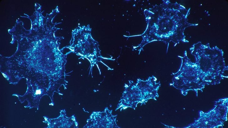 Cancer cells Image credit Pixabay/Skeeze