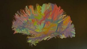 Is neurodiversity the solution to your cybersecurity skills deficit? (Image Credit: Ian Murphy)